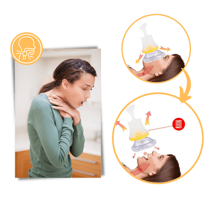 Anti-choking device – Immediate aid for choking incidents