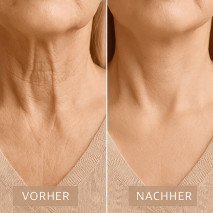 Neck Lifting Strips 20 Pieces