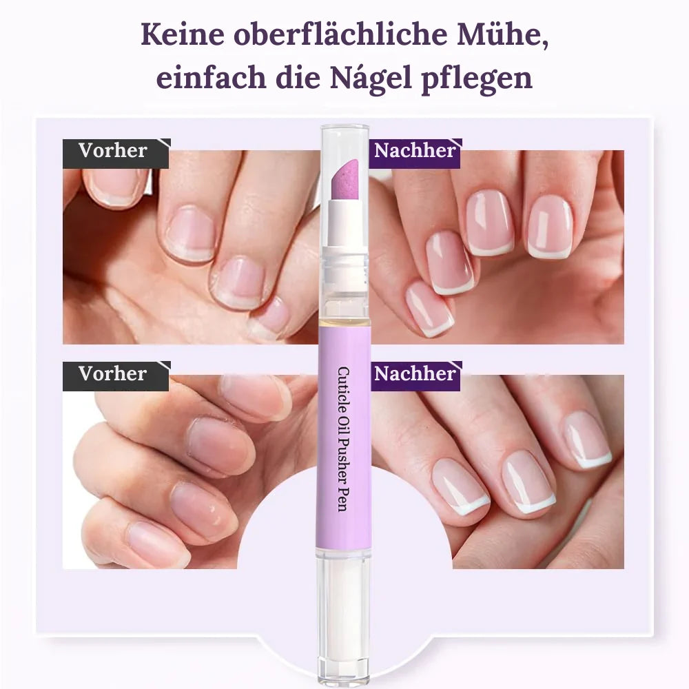 VitaNail™ — Strong, Radiant Nails That Enchant Instantly