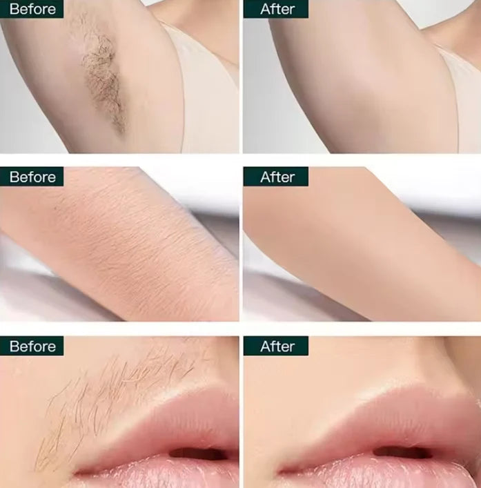 PureGlide Electric Trimmer for Body Grooming
