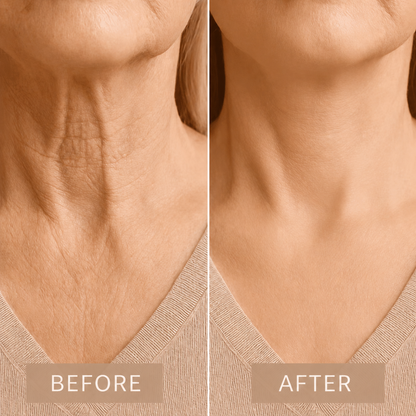 Neck Lifting Strips 20-Pack